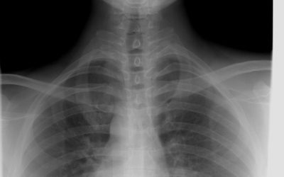 Se celebró el Día Mundial de la Radiología
