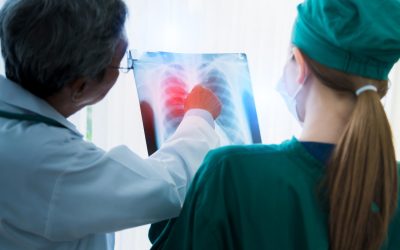 Qué es el adenocarcinoma pulmonar